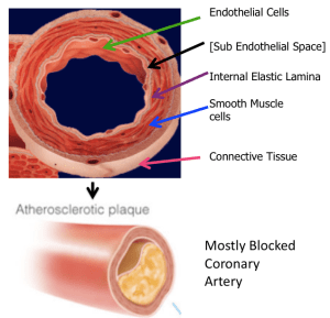 Coronary Artery Diagram